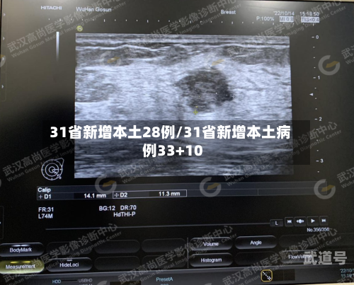 31省新增本土28例/31省新增本土病例33+10